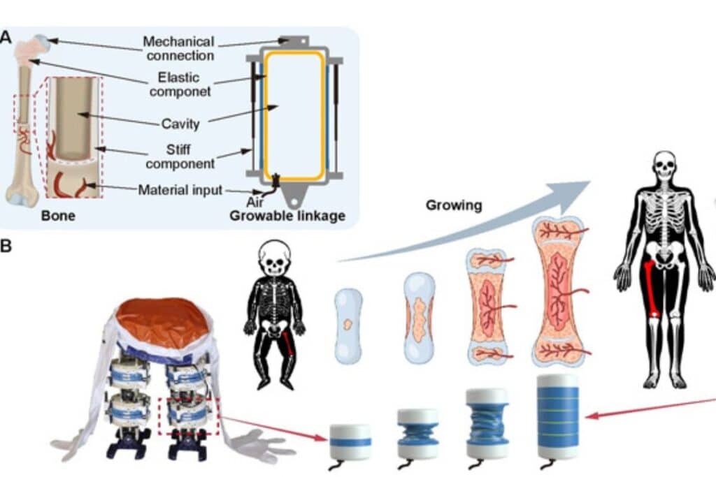 Schéma sur l'allongement osseux et dispositifs croissants.